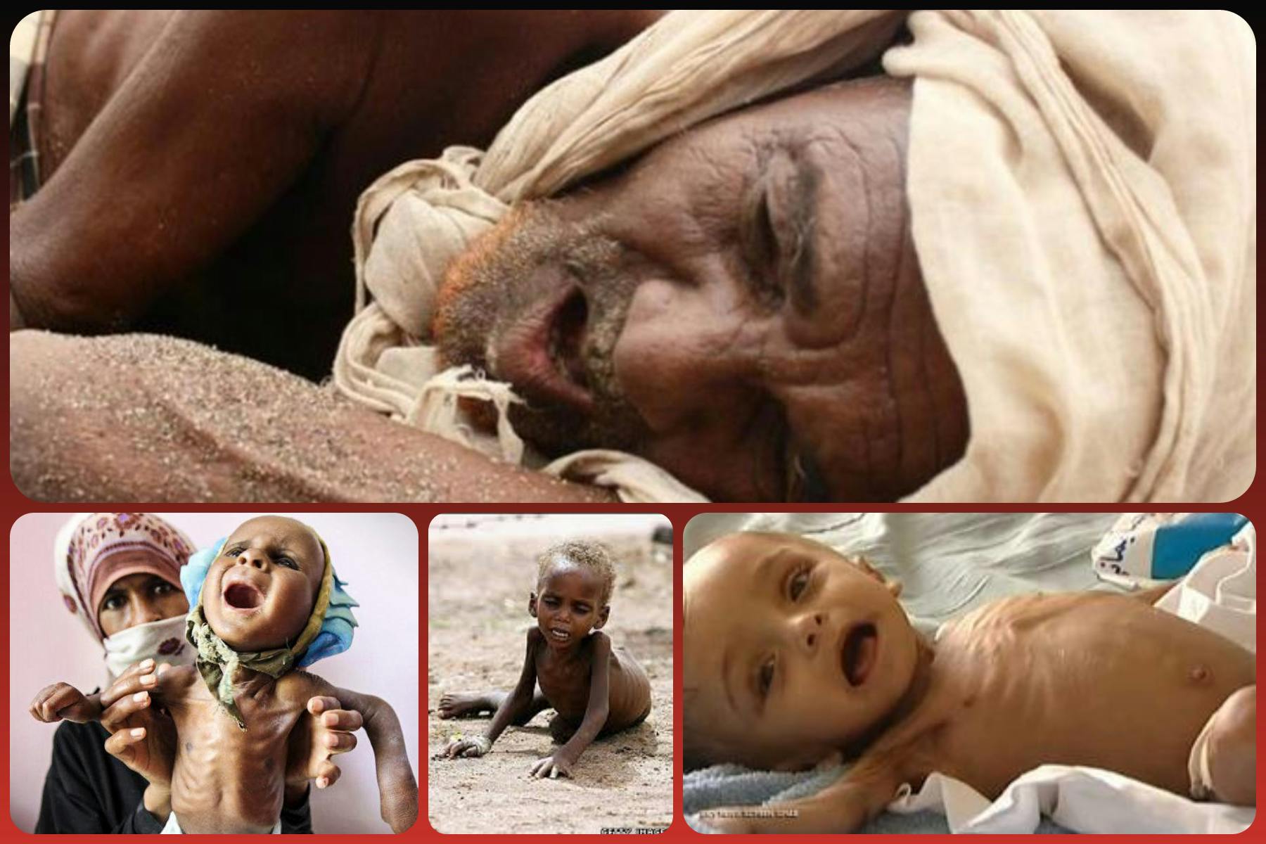 Cover Image for الأمم المتحدة: 20 مليونا يواجهون المجاعة بسبب الحرب